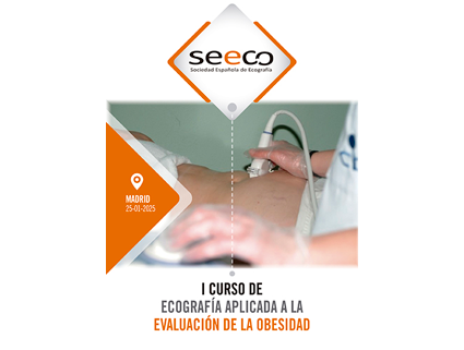 Curso de Ecografia