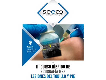 III Curso Híbrido de Ecografía MSK Lesiones de tobillo y pie