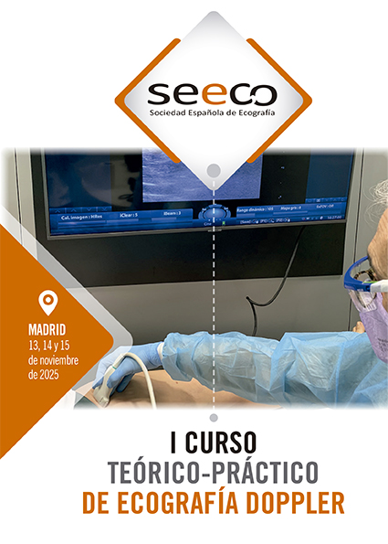 I Curso Teorico Practico de Ecografia Doppler