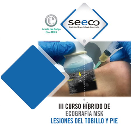 III Curso Híbrido de Ecografía MSK - Lesiones de Tobillo y Pie