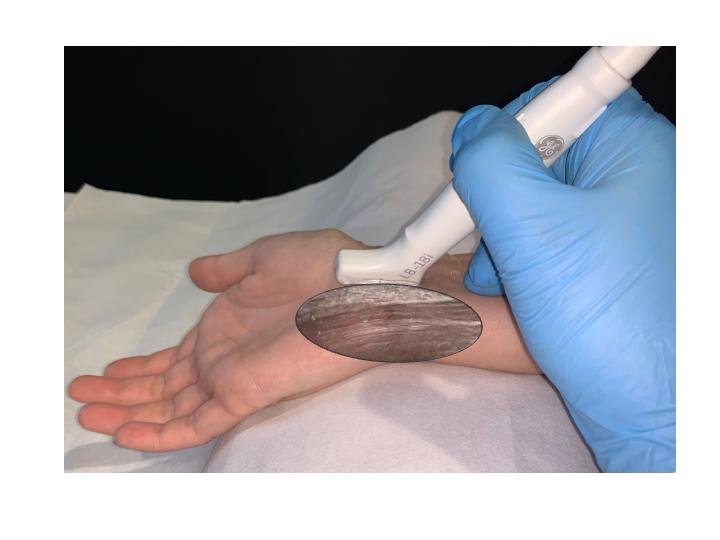Curso Híbrido de Mano y Muñeca (NIVEL I)