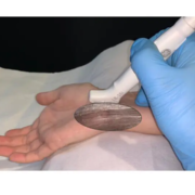 Curso Híbrido de Ecografía Mano y Muñeca