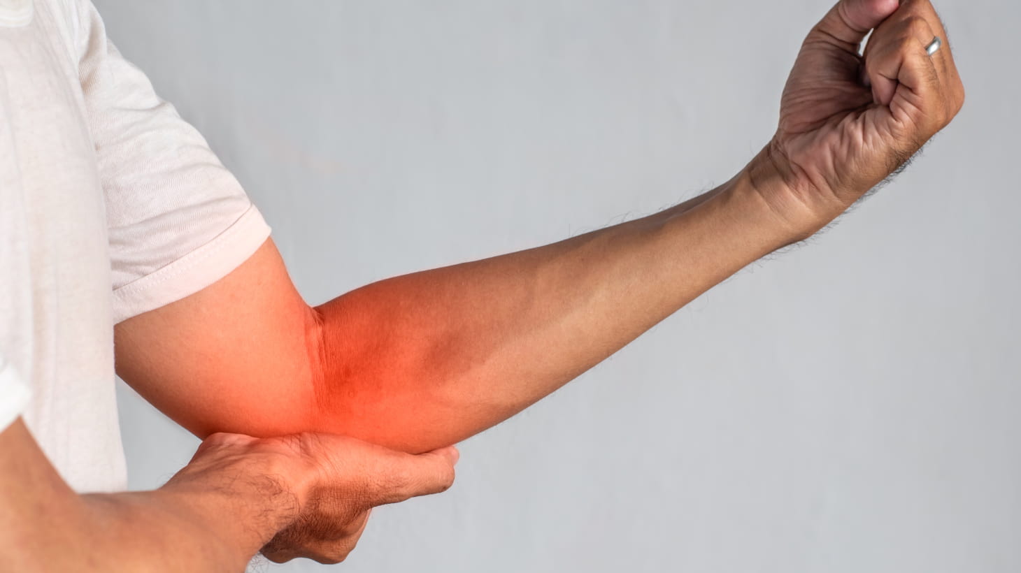 Imagen ecográfica de tendinopatía epitroclear: engrosamiento del tendón flexor común en el codo